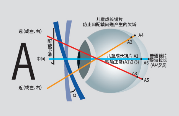 Ҋ(jin)ǌ(du)Q(chng)xR